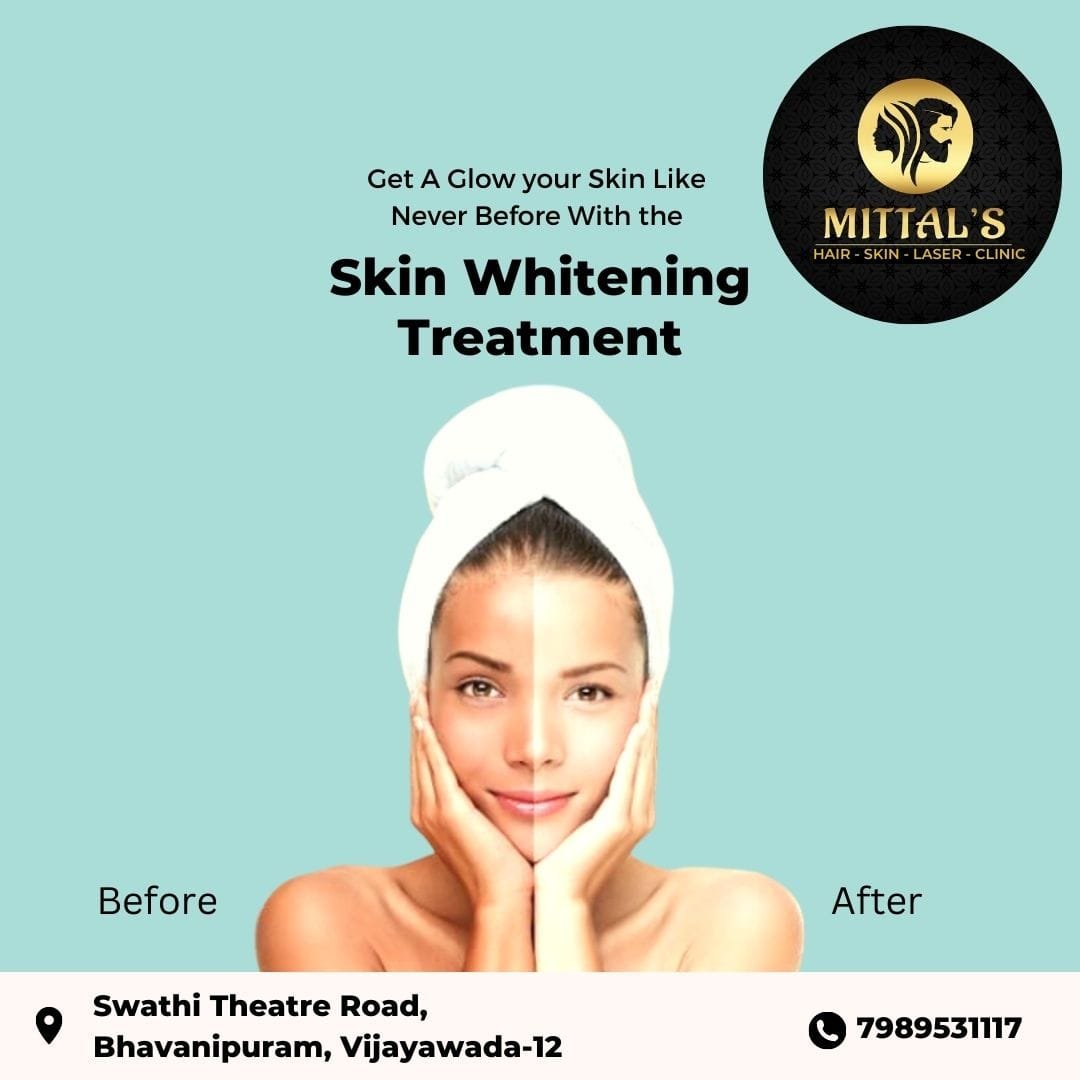 Dr. Mittal Mittal s Hair skin Lazer clinic